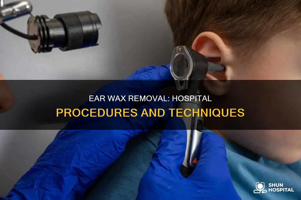 how to remove ear wax in hospital