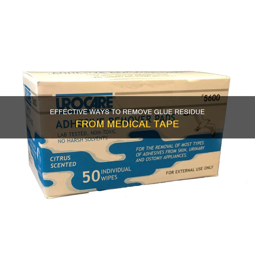 how to remove glue from hospital tape