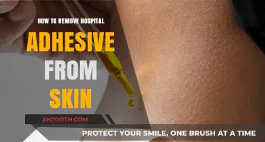 Effective Ways to Remove Hospital Adhesive from Skin