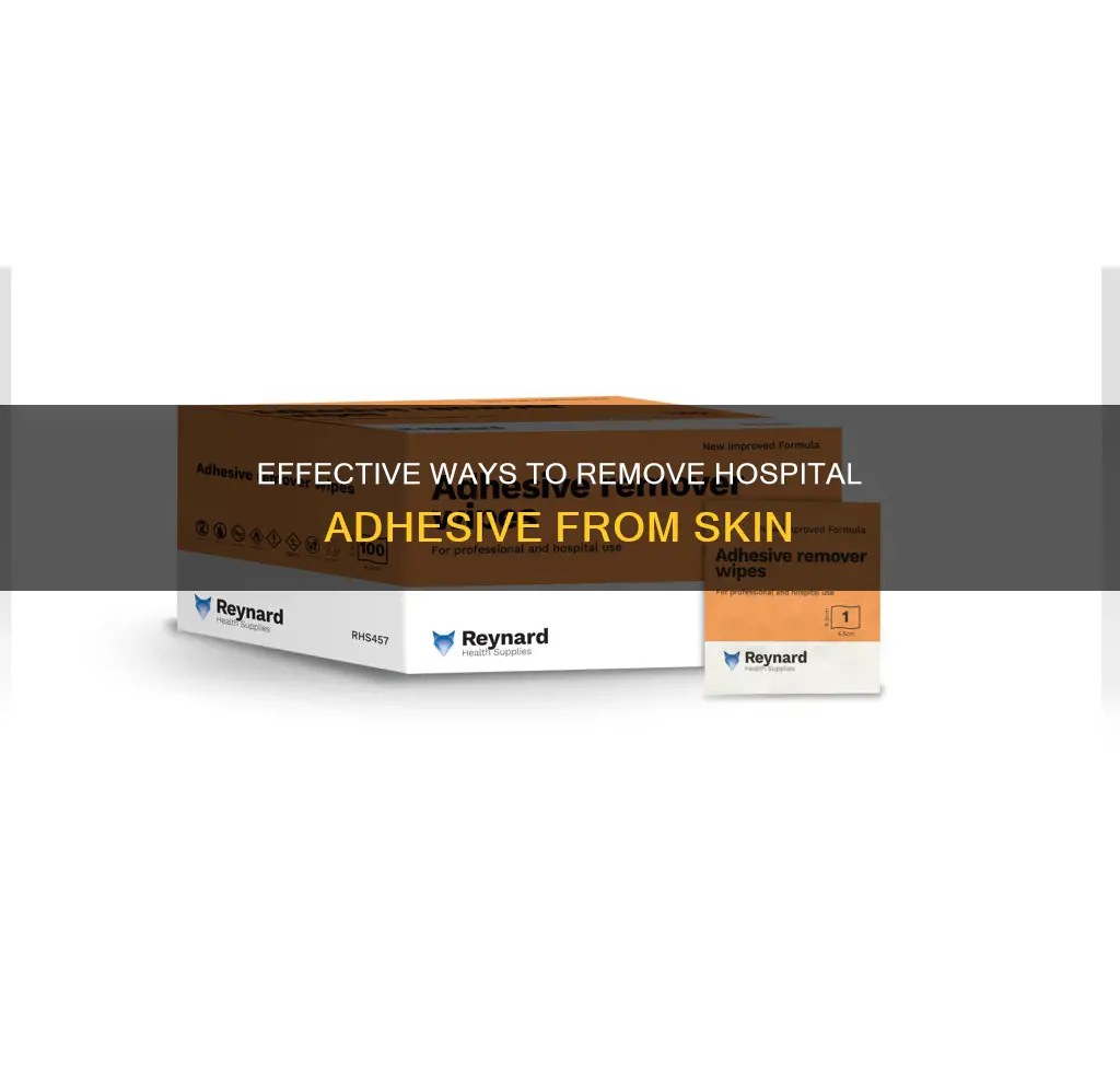 how to remove hospital adhesive from skin