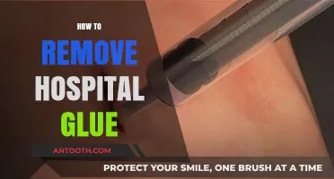 Effective Ways to Safely Remove Hospital Glue at Home