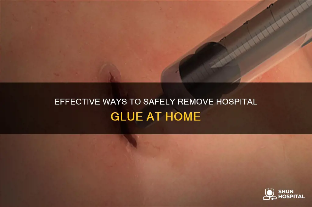 how to remove hospital glue