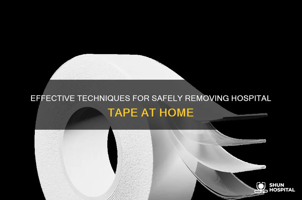 how to remove hospital tape