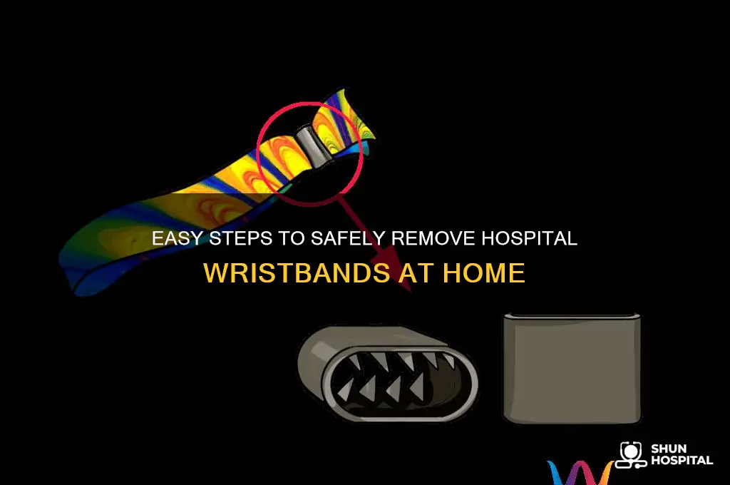 how to remove hospital wristband