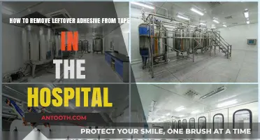 Effective Methods to Remove Tape Adhesive Residue in Hospital Settings