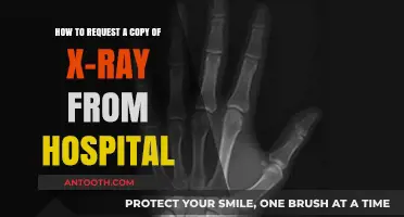 How to Request Your X-Ray Copy from the Hospital Easily