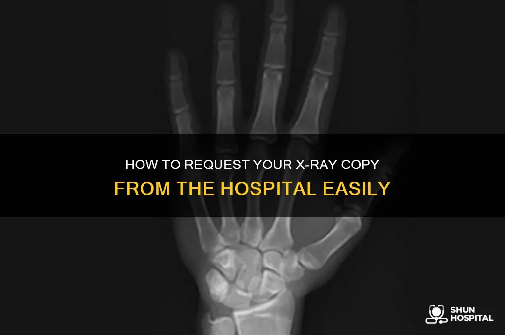 how to request a copy of x-ray from hospital