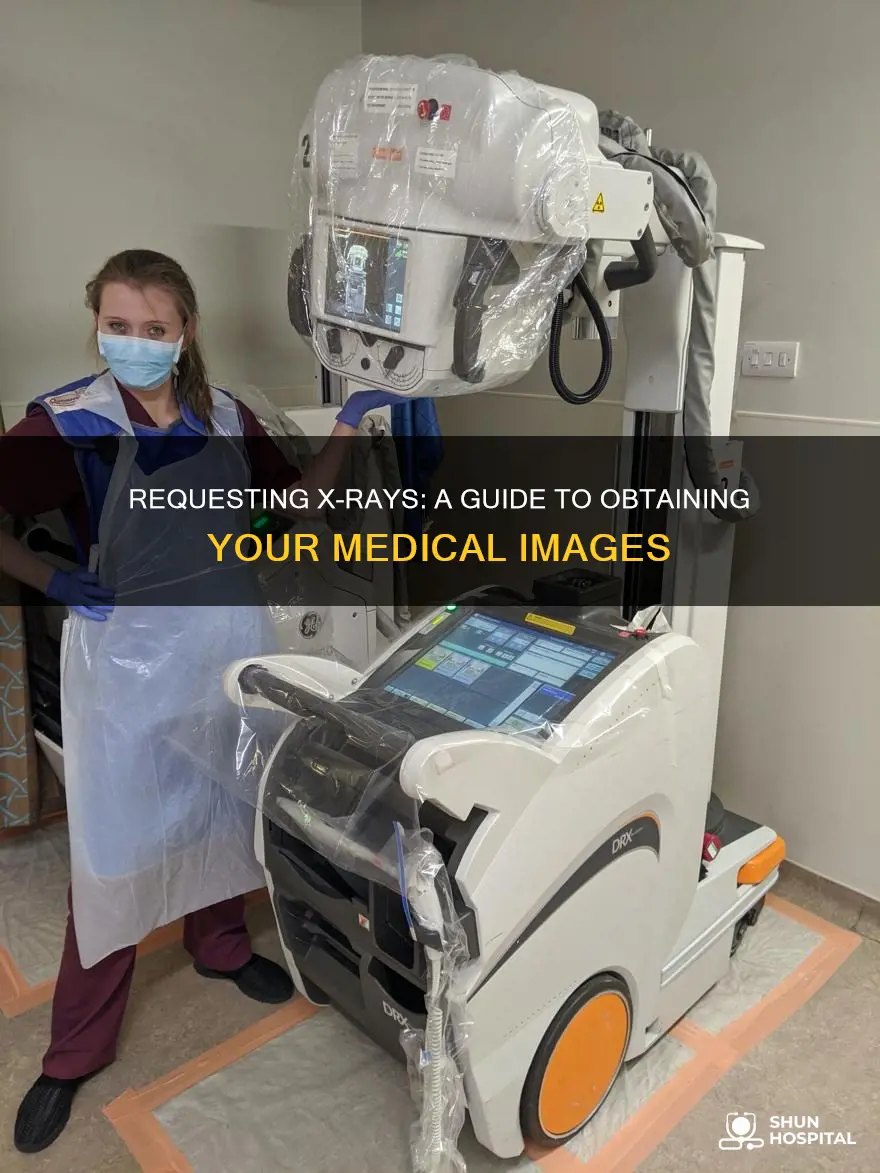 how to request x ray from hospital