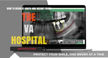 VA Hospital X-Ray Requests: A Step-by-Step Guide to Obtaining Reports