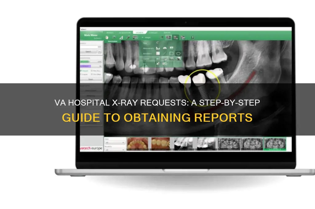 how to request xrays and report from the va hospital