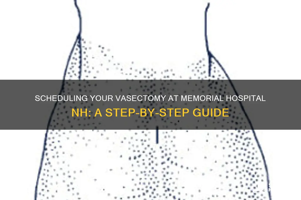 how to schedule a vasectomy at memorial hospital nh