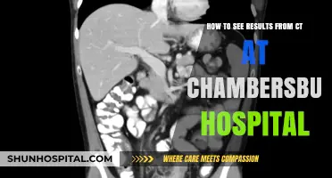 Viewing Your CT Scan Results at Chambersburg Hospital: A Step-by-Step Guide