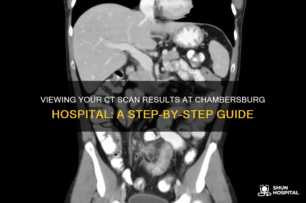 how to see results from ct at chambersburg hospital