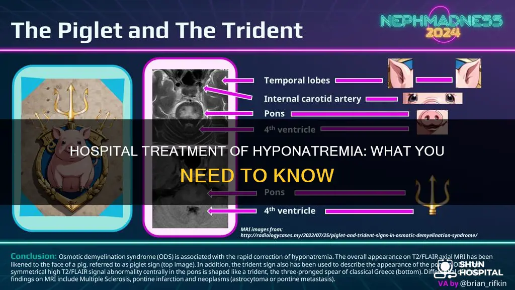 how to treat hyponatremia in the hospital