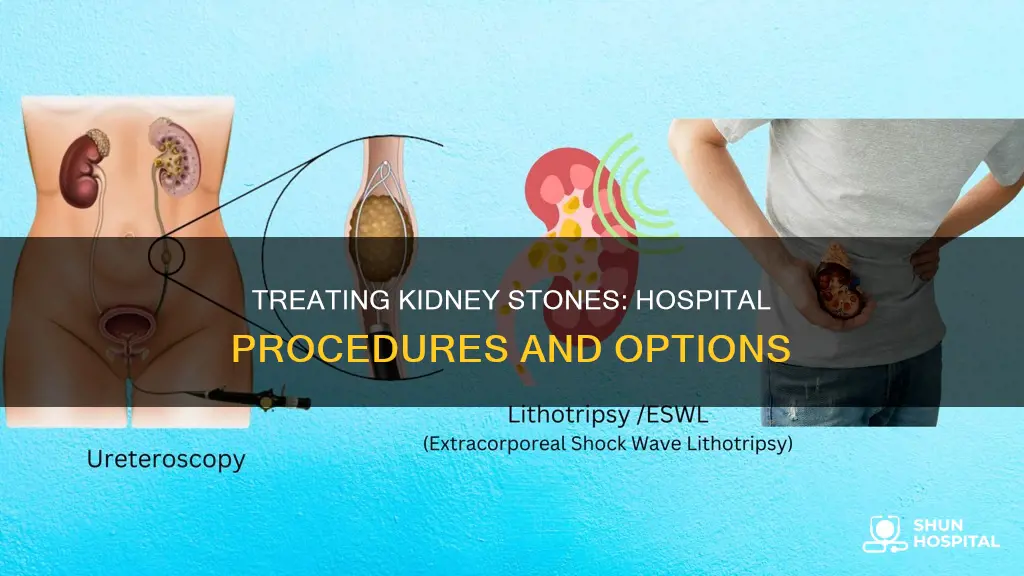 how to treat kidney stones in hospital