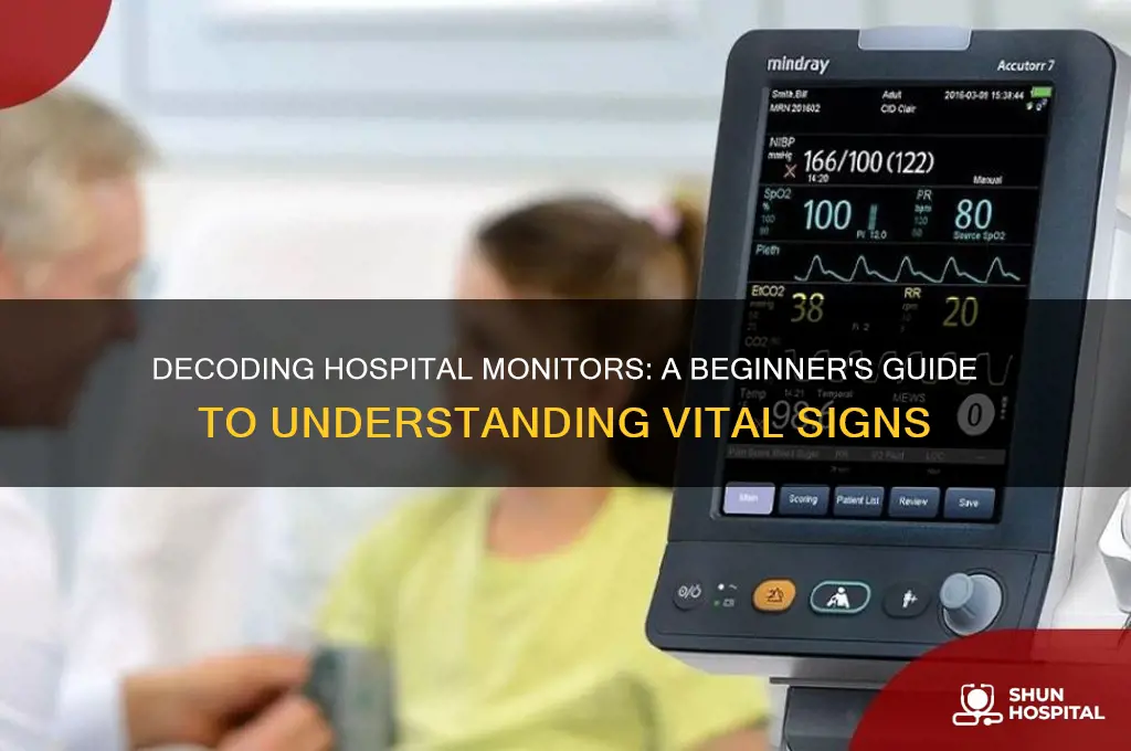 how to understand hospital monitors