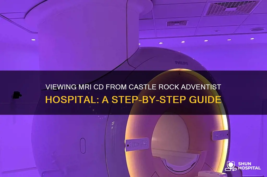 how to view mri cd castle rock adventist hospital