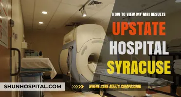 Viewing Your MRI Results at Upstate Hospital Syracuse: A Guide