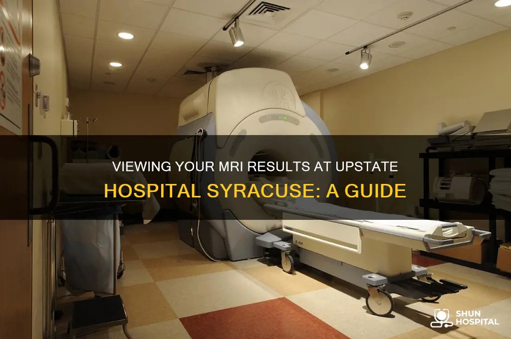 how to view my mri results upstate hospital syracuse