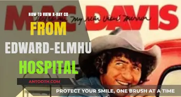 Viewing Edward-Elmhurst Hospital X-Ray CDs: A Step-by-Step Guide