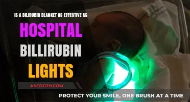 Bilirubin Blanket vs. Hospital Lights: Which Treatment is More Effective?