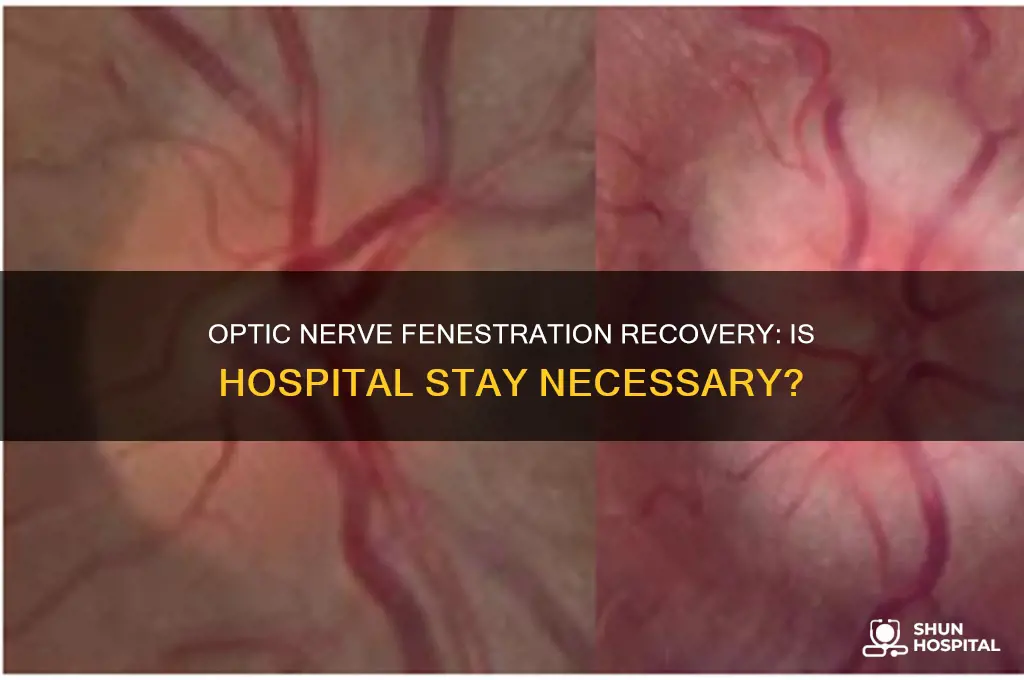 is a hospital stay required after a optic nerve fenesteration