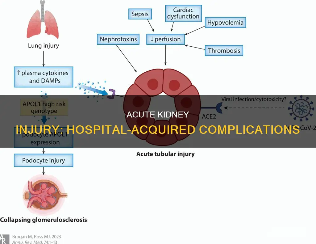 is acute kidney injury a hospital acquired