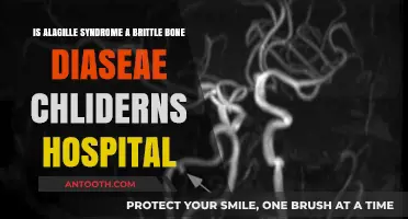Alagille Syndrome and Brittle Bones: Understanding the Connection in Children