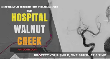 Endovascular Thrombectomy at John Muir Walnut Creek: Availability Explained