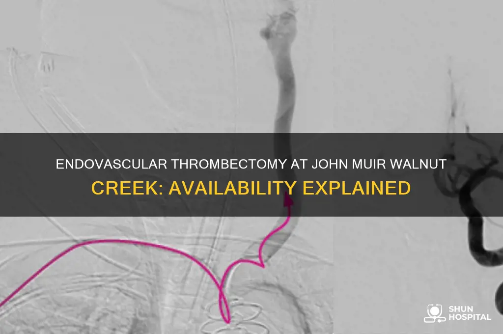 is endovascular thrombectomy available at john muir hospital walnut creek