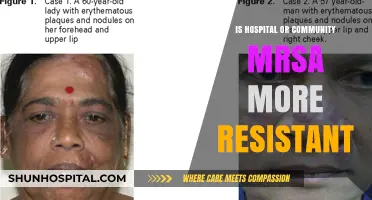 MRSA Resistance: Hospital vs Community