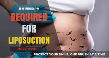 Is Hospitalization Necessary for Liposuction? Understanding Your Options