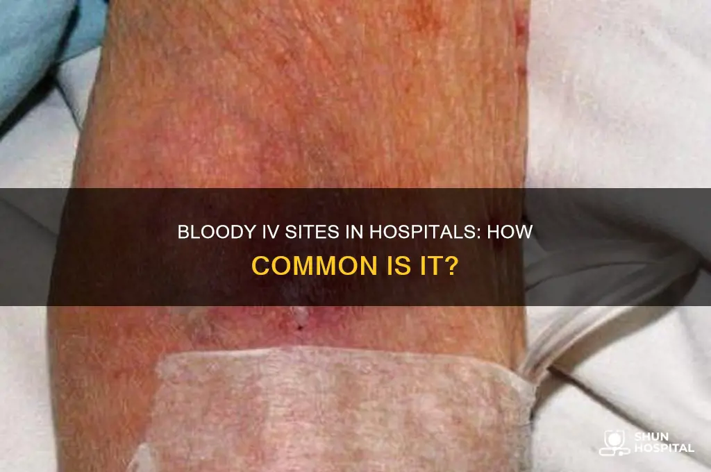 is it common to have bloody iv site in hospital