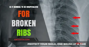 Is Hospitalization Common for Broken Ribs? Understanding Treatment Options