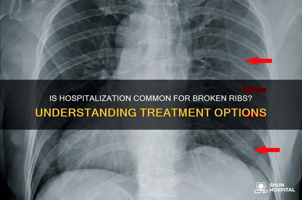 is it normal to be hospitalized for broken ribs