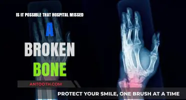 Could a Hospital Overlook a Broken Bone? Uncovering Diagnostic Oversights