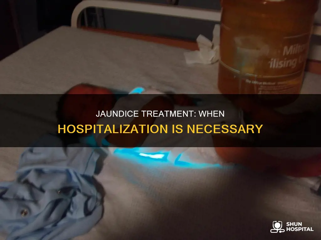 is jaundice treatment need to be hospitalized