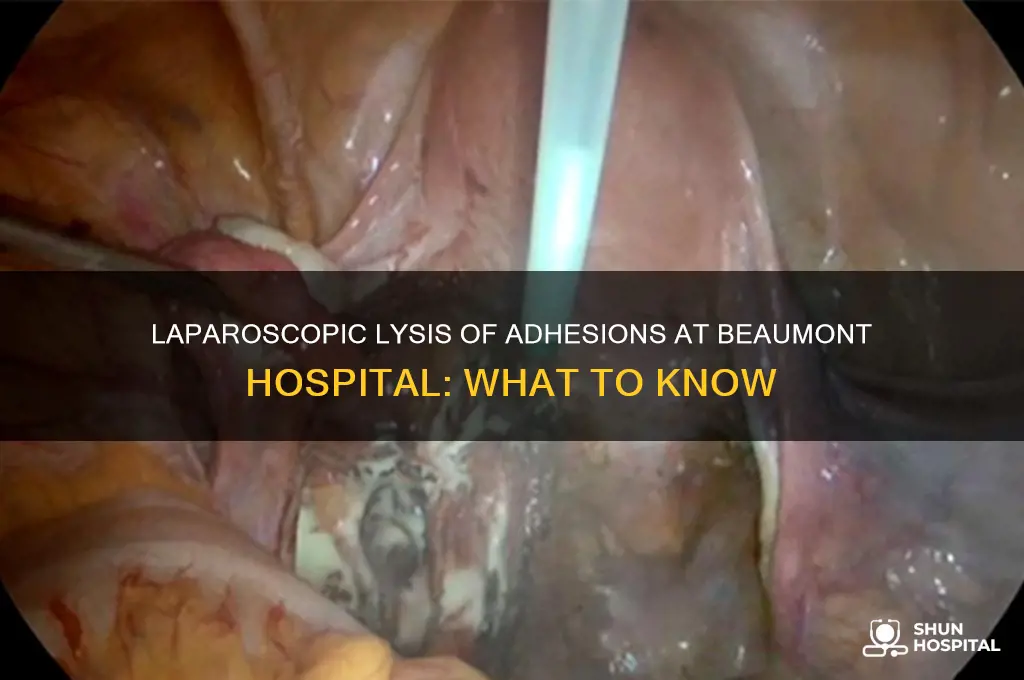 is laparoscopic lysis of adhesions performed at beaumont hospital