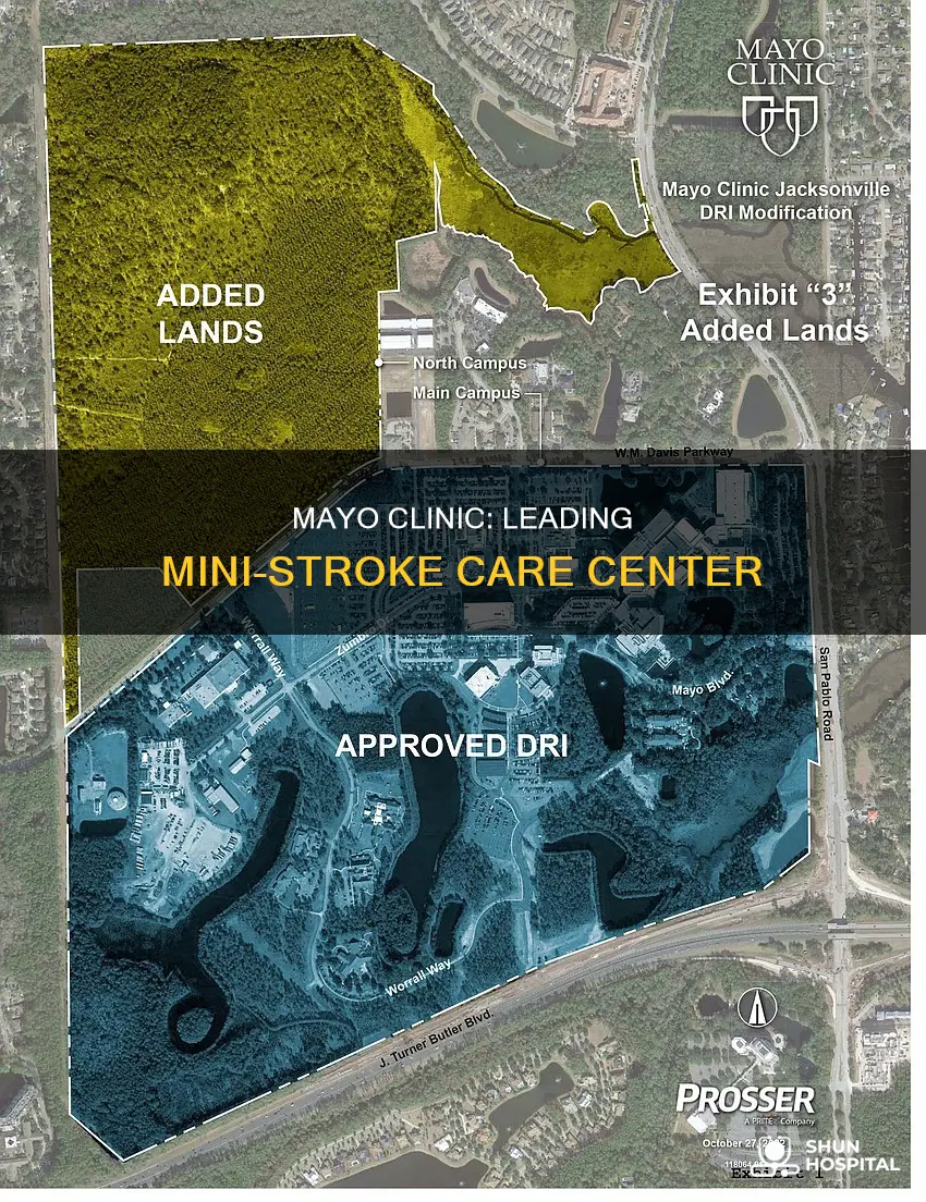 is mayo clinic good mini stroke hospital