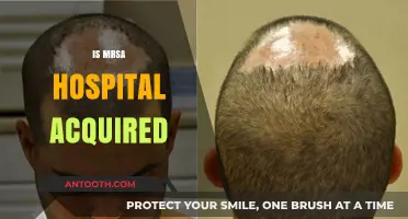 Is MRSA Hospital-Acquired? Unraveling the Origins and Risks