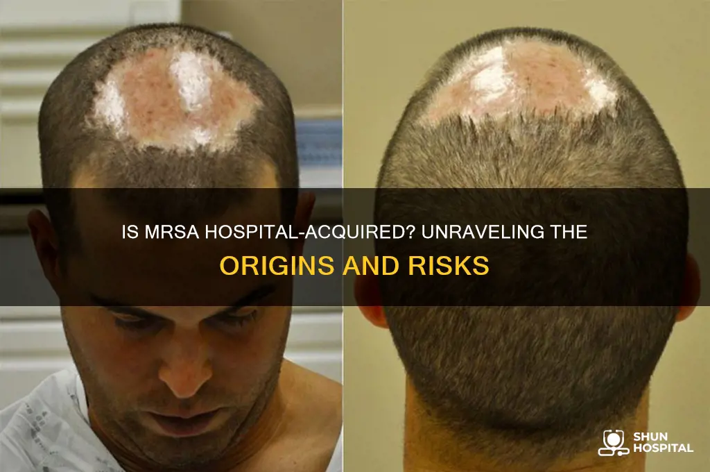 is mrsa hospital acquired