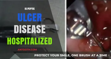 Is Peptic Ulcer Disease a Hospitalization Concern? What You Need to Know