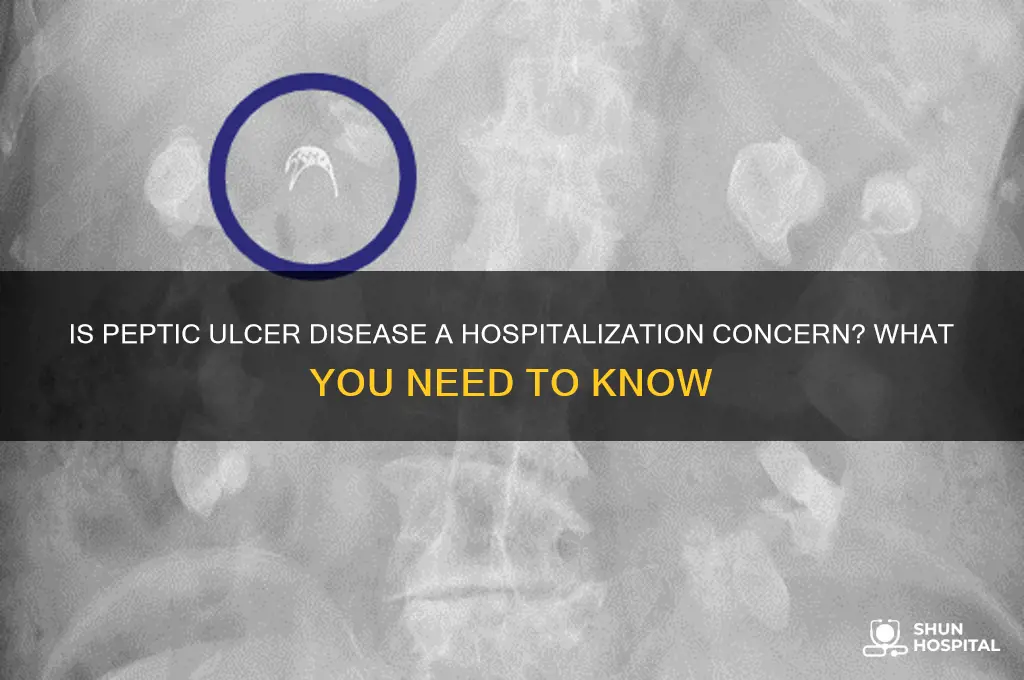 is peptic ulcer disease hospitalized