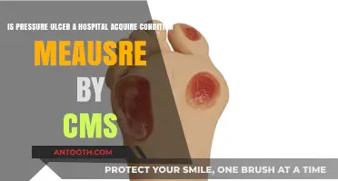 Is Pressure Ulcer a CMS-Measured Hospital-Acquired Condition?