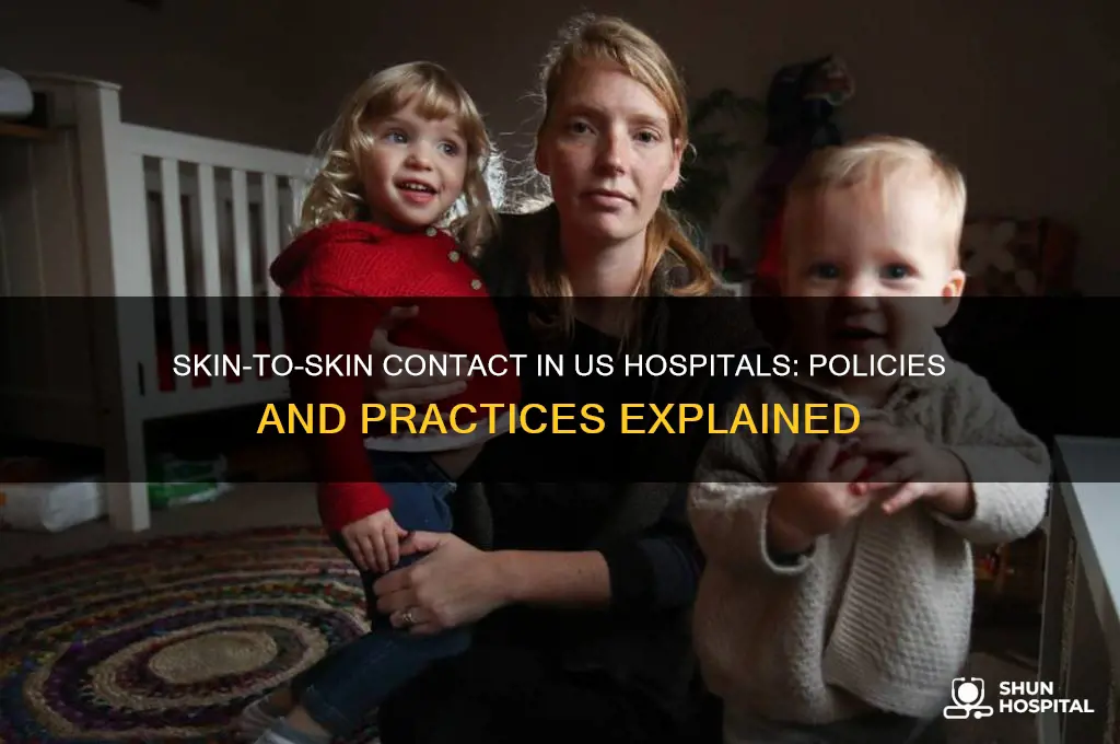 is skin on skin contact charged in us hospitals