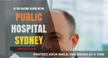 Gastric Sleeve Surgery in Sydney Public Hospitals: What You Need to Know