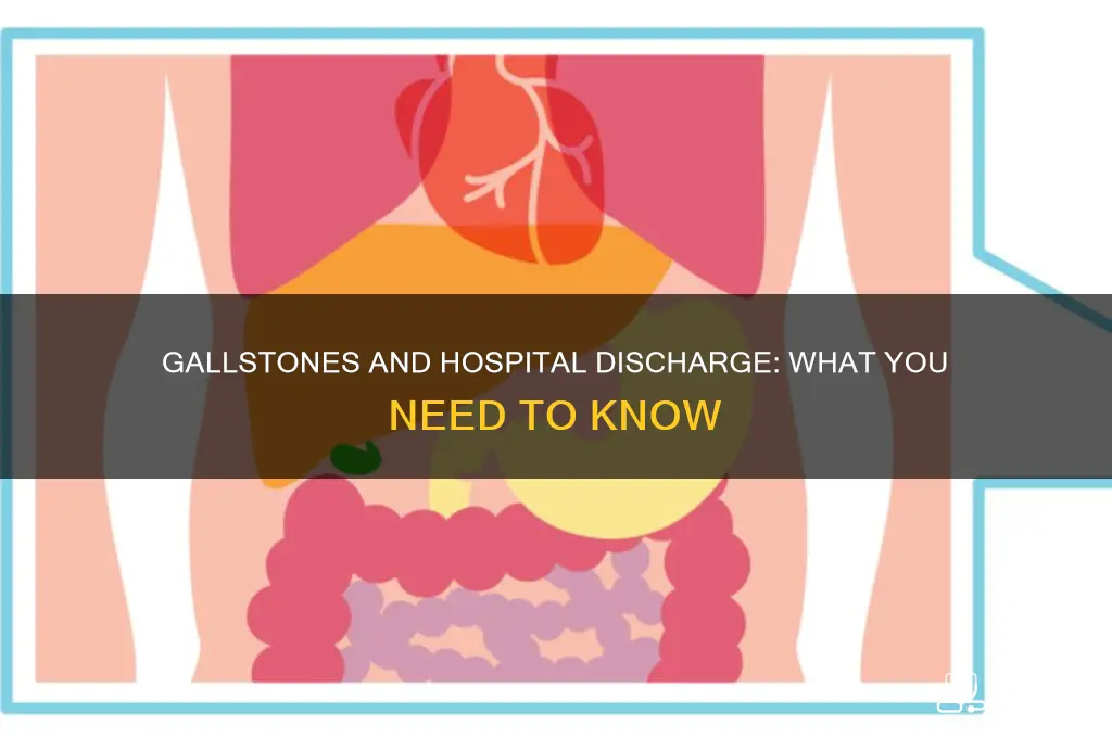 is the hospital supposed to send you home with gallstones
