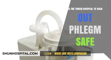 Is Tubein Hospital's Phlegm Suction Procedure Safe? Expert Insights