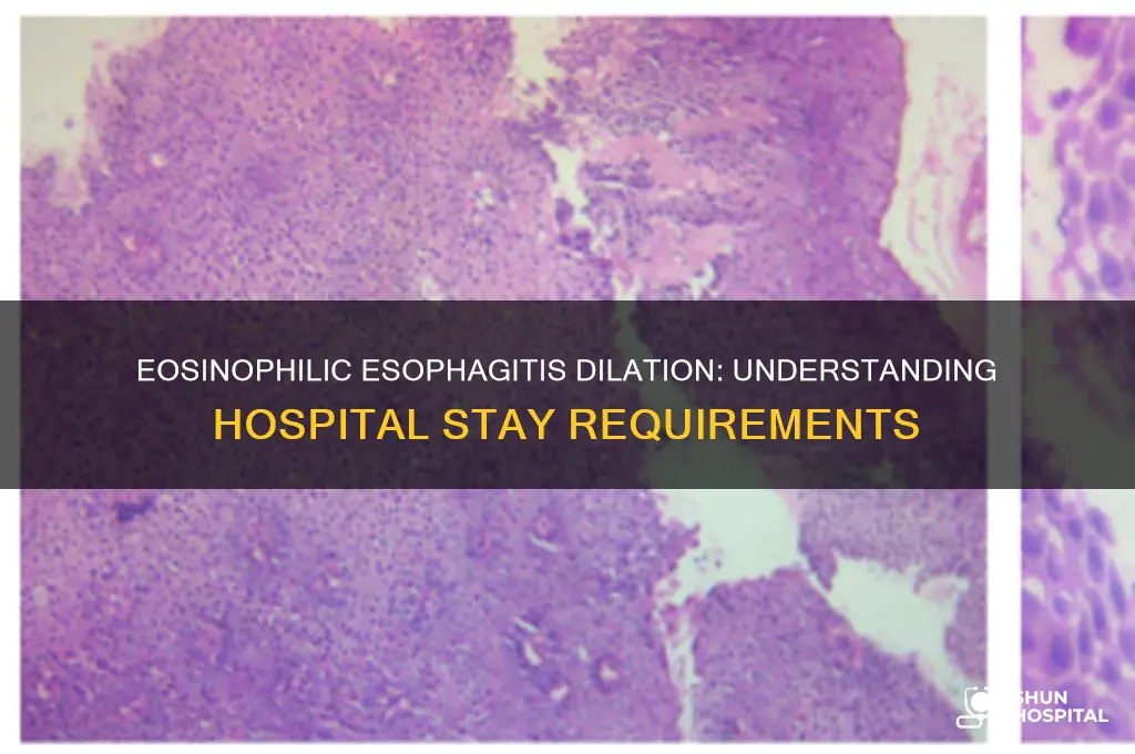is there a hospital stay with eosinophilic esophagitis dilation