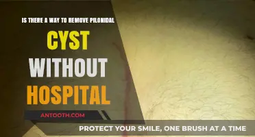 At-Home Pilonidal Cyst Removal: Safe Alternatives to Hospital Procedures